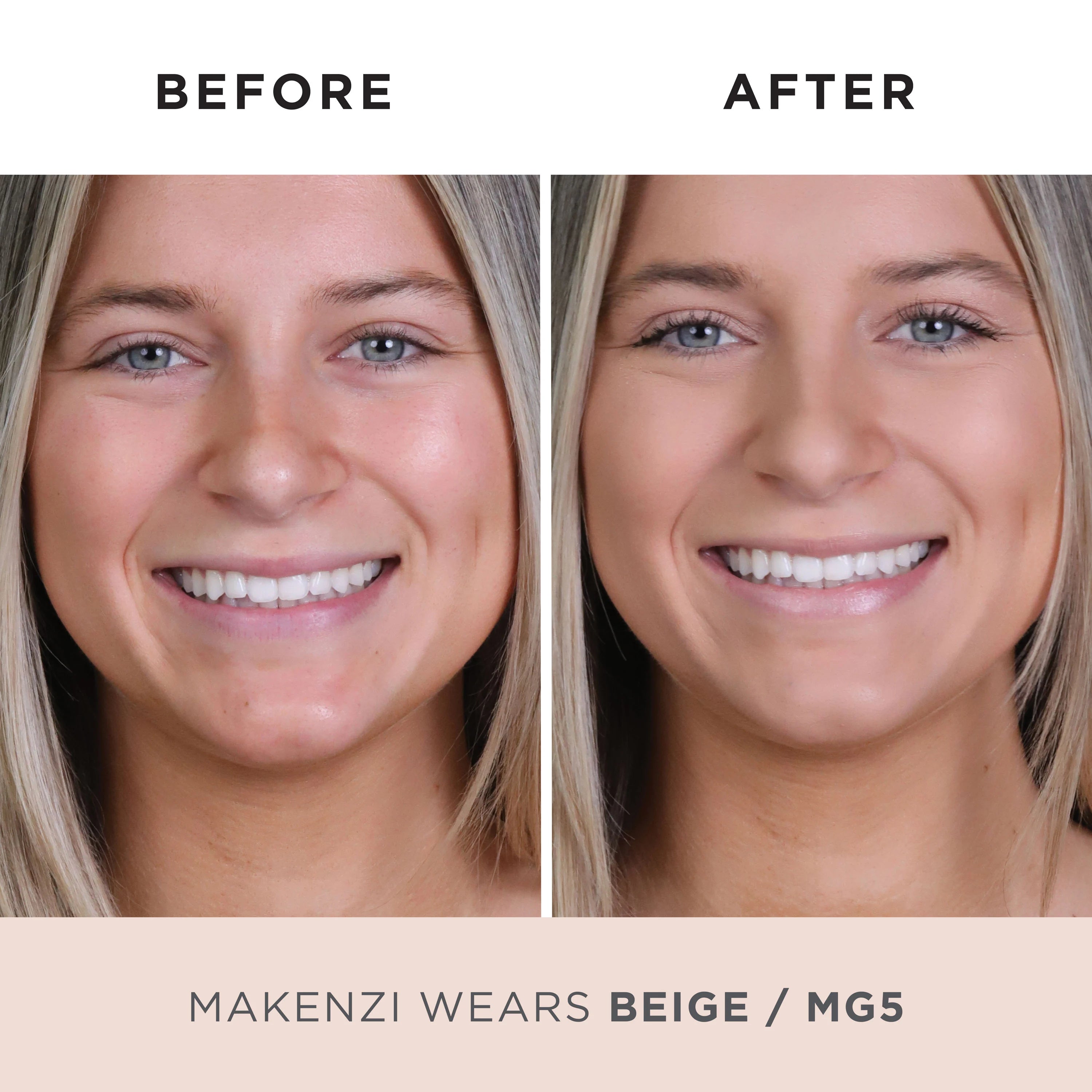Model Before and After MG5 #almond-mg5-light-medium-w/-golden-undertones