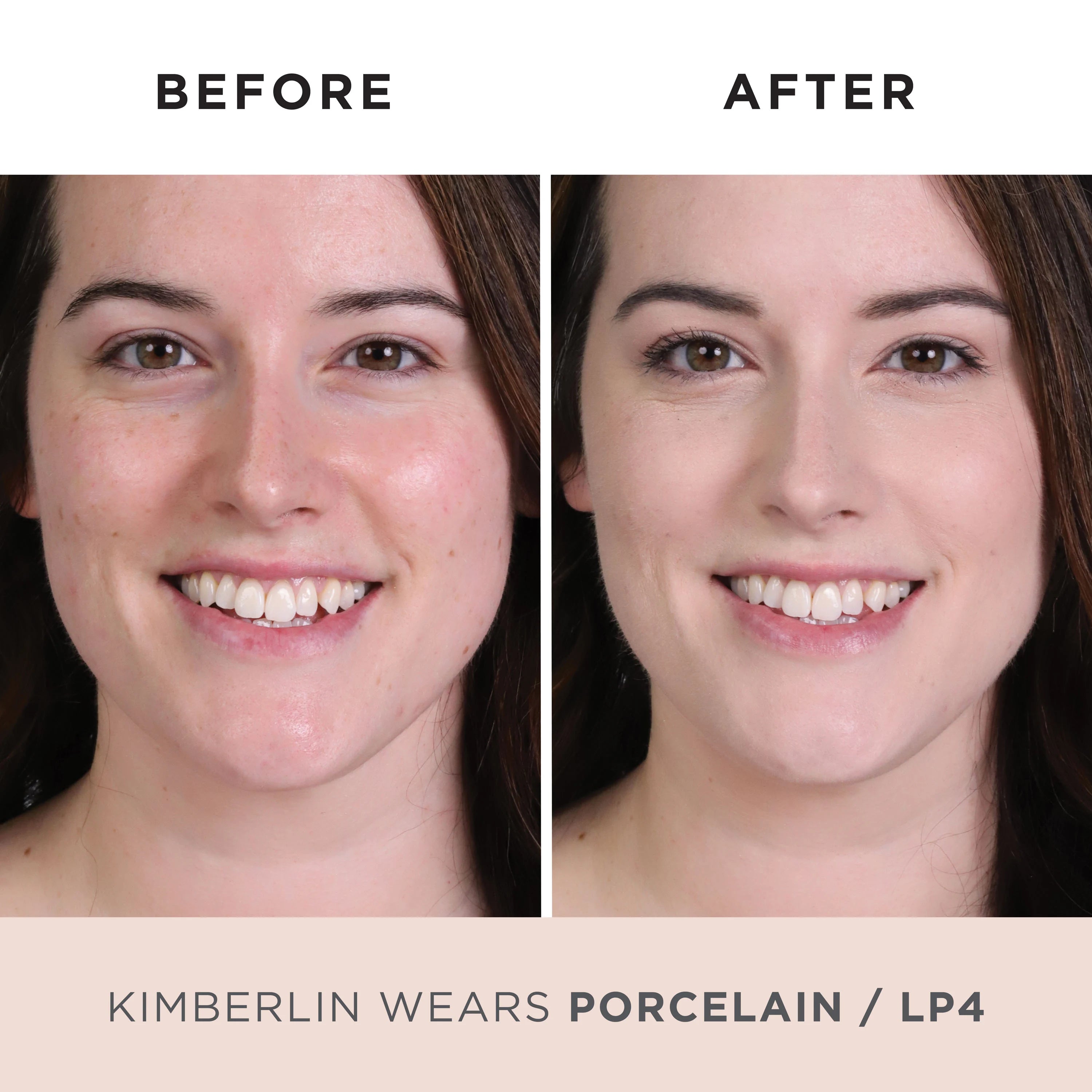 Model Before and After LP4 #porcelain-lp4-fair-w/-pink-undertones