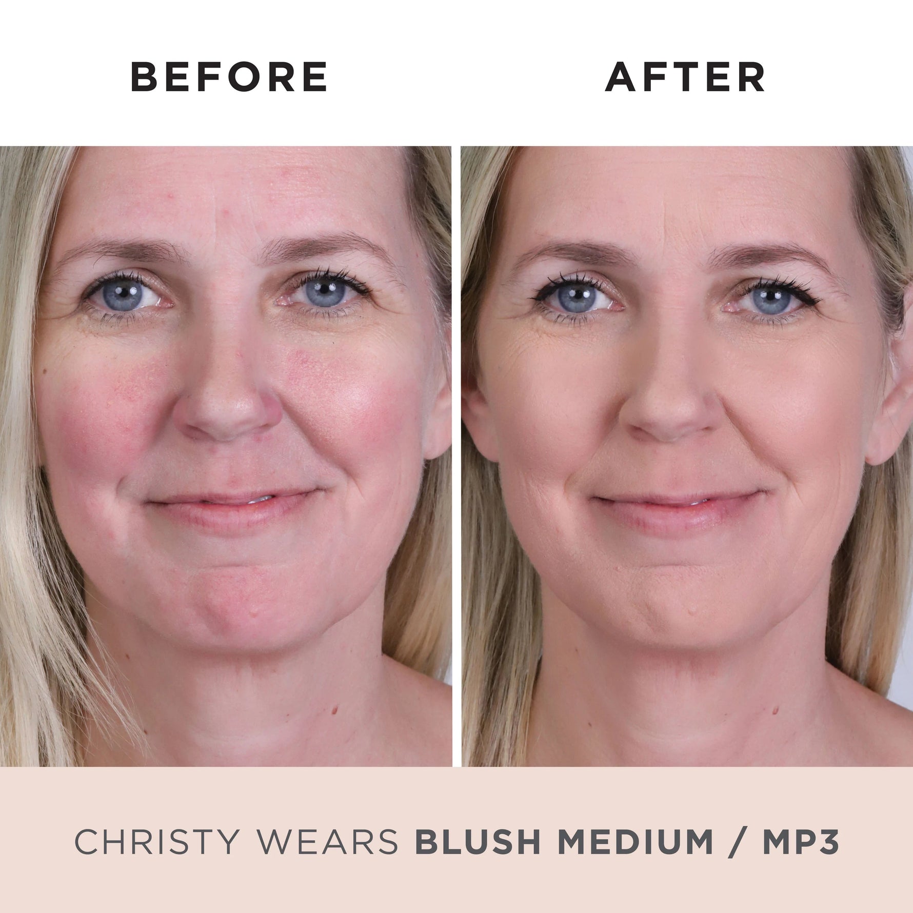 Model Before and After MP3 