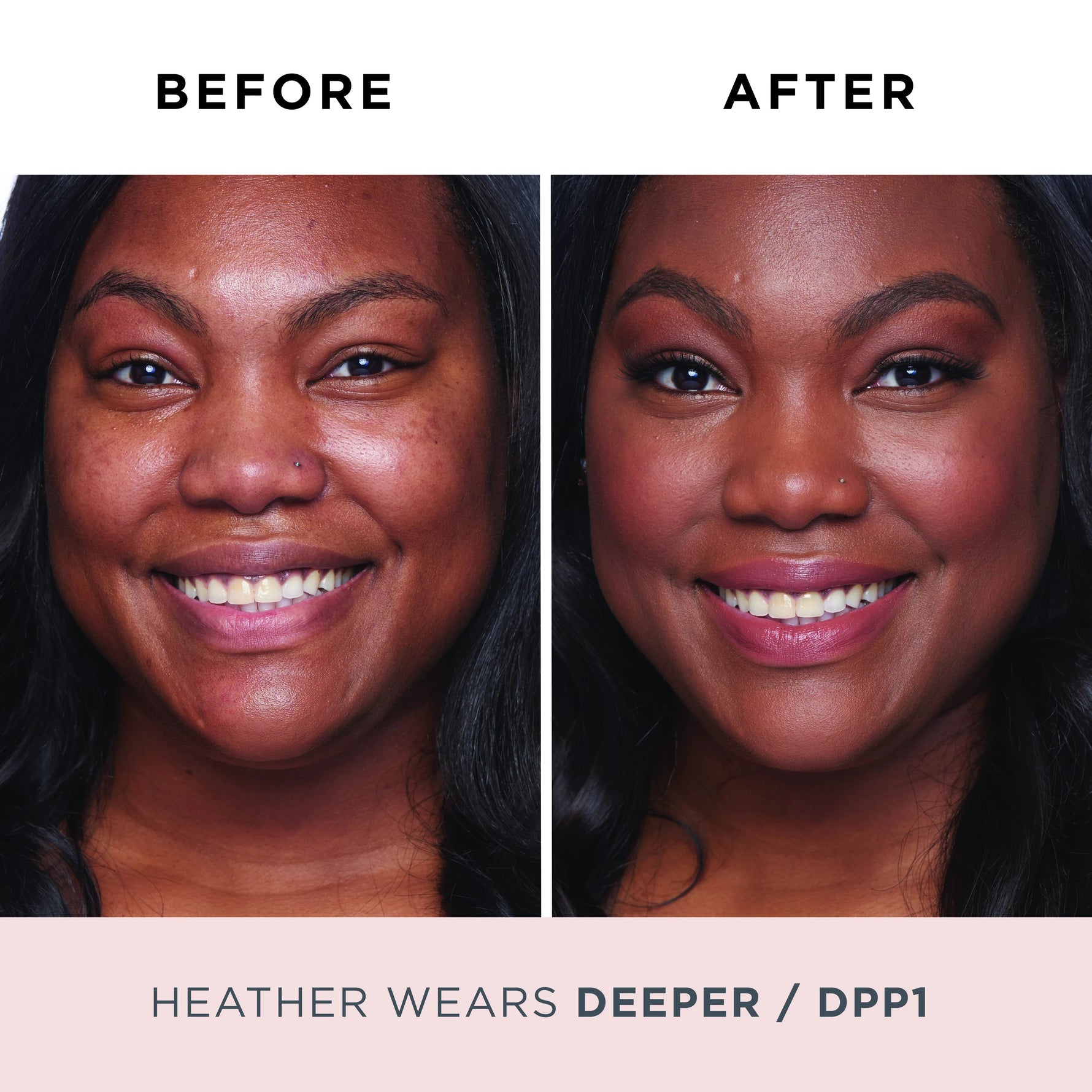 Model Before and After DPP1 